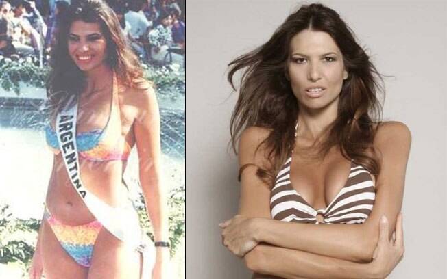 Em 2009, A Miss Argentina 1994 Solange Magnano morreu três dias depois de realizar um tratamento para aumento dos glúteos