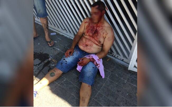 Torcedor palmeirense ferido durante confronto com corintianos na rua Turiassu, na zona oeste de São Paulo