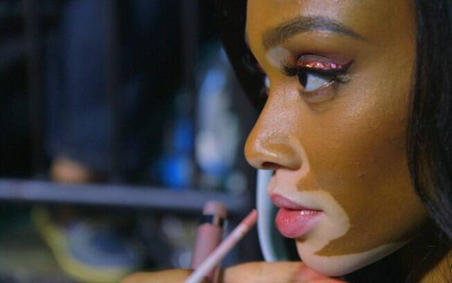 Winnie Harlow é uma modelo com vitiligo e faz sucesso nas passarelas