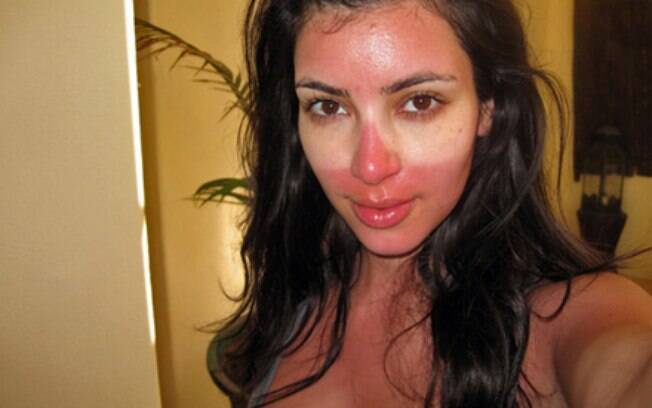 Kim Ops! Kardashian esqueceu de tirar os óculos escuros na hora de tomar sol