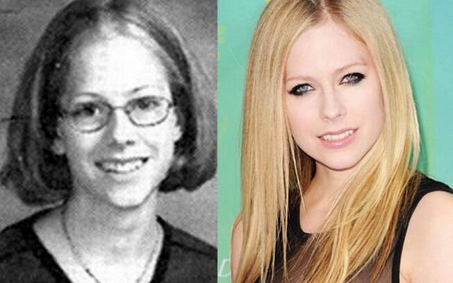 Resultado de imagem para famosos antes e depois