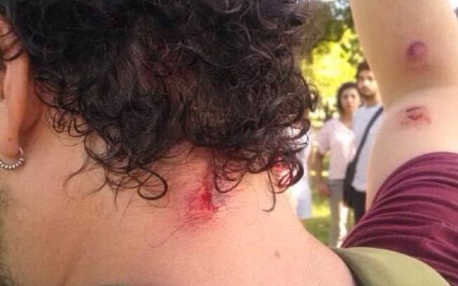Imagens mostram feridos em embate entre ocupantes e PM horas antes do jogo entre Brasil e México