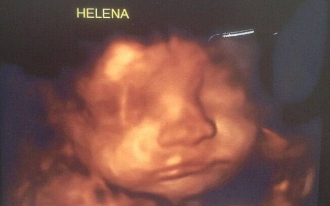 Rodrigo Faro postou uma imagem da ultrassonografia de sua terceira filha, Helena, na tarde desta terça-feira (02)
