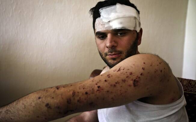 Libanês foi ferido após segundo foguete de rebeldes sírios atingir sua casa em Hermel (29/05)