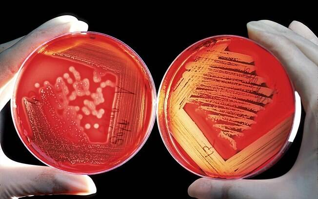 Segundo relatório da ONU, vírus, bactérias, parasitas e fungos podem causar 10 milhões de mortes ao ano pelo mundo