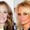 Nem sempre cirurgia plástica ajuda a manter o rosto conservado. Julia Roberts e Pamela Anderson têm 44 anos. Foto: Getty Images/SplashNews