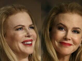 Nicole Kidman surge com lábios inchados e quase irreconhecível em tapete vermelho de Cannes