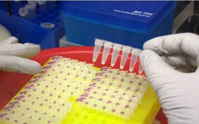 Mais de 600 amostras de sangue de pacientes da Guiné serão analisadas