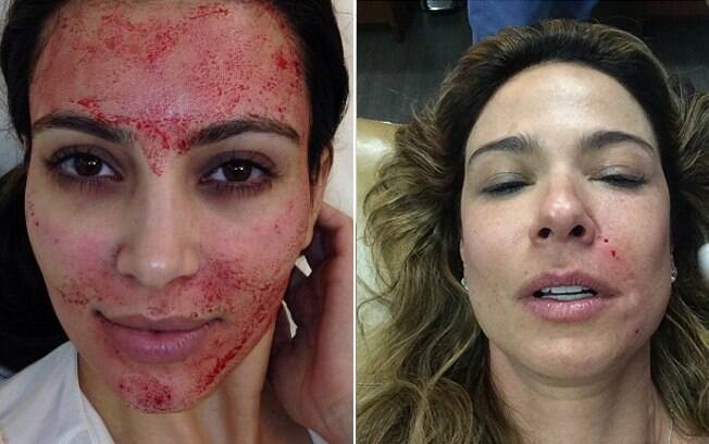 Kim Kardashian e Luciana Gimenez são duas das celebridades adeptas do