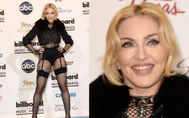 A rainha do pop Madonna sempre teve como marca registrada os dentes levemente separados
