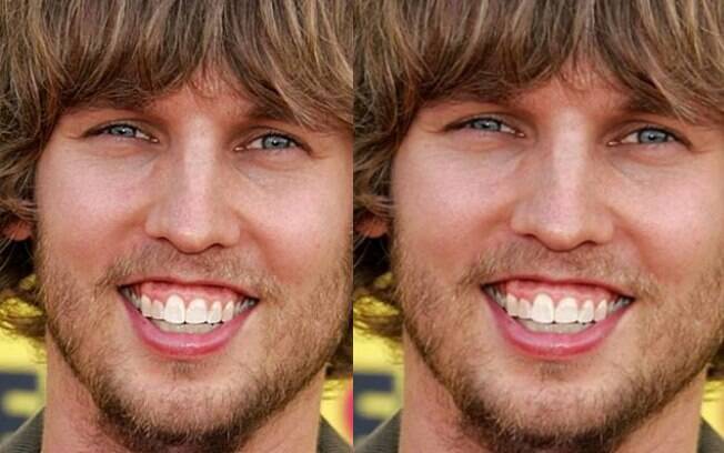 Jon Heder e os seus dentes sem grandes mudanças 
