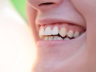 Boa higiene bucal e consultas periódicas ao dentista ajudam a prevenir problemas bucais
