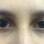 O olho da esquerda está com a lente Acuvue Define. O da direita não tem lente de contato. Foto: ig