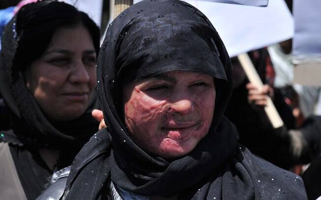 Afeganistão: afegã com rosto marcado por ataque de ácido protesta contra execução pública de suposta adúltera (2012). Foto: AFP
