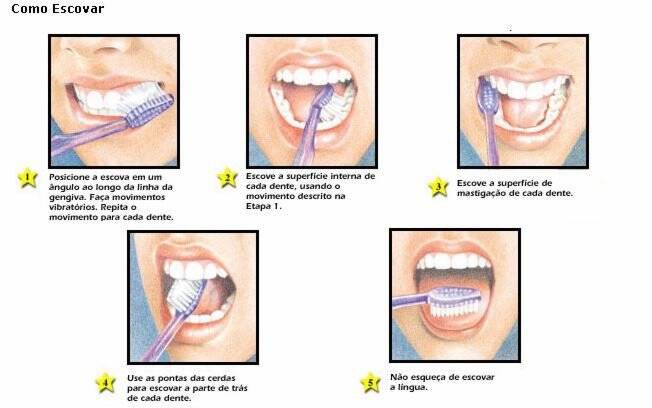 Cuidados simples na escovação fazem grande diferença na higiene bucal