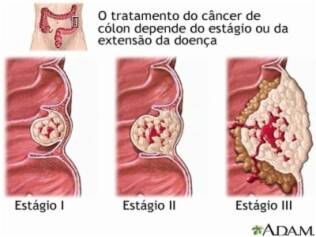 Exames funcao hepatica