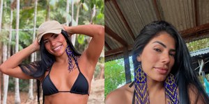 Marciele relata como quase ficou careca ao descobrir doença