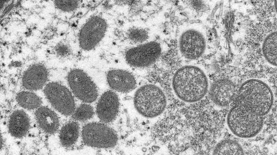 'Monkey pox' virus