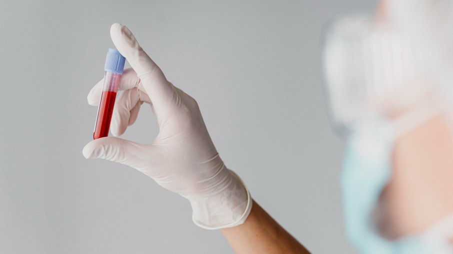 O diagnóstico das hepatites virais é feito por meio de testes rápidos ou laboratoriais, disponíveis gratuitamente no SUS