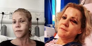 Mulher supera AVC, câncer e coma e vira exemplo