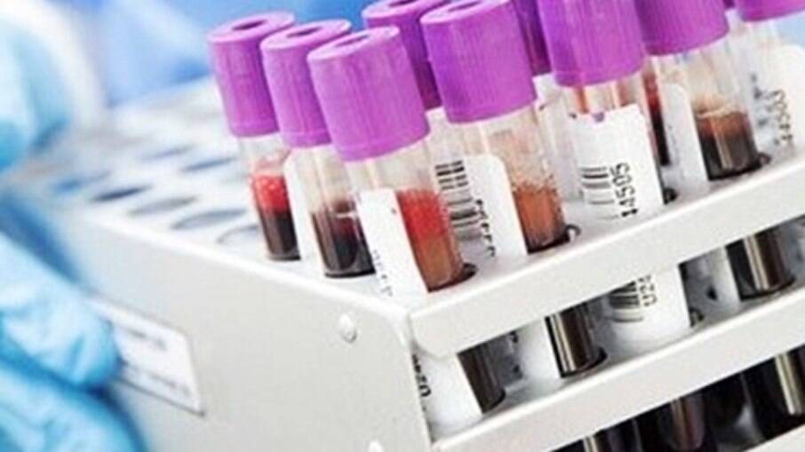 Método desenvolvido pela Unicamp e Unifesp possibilita diagnóstico pela análise de metabólitos em amostras sanguíneas.