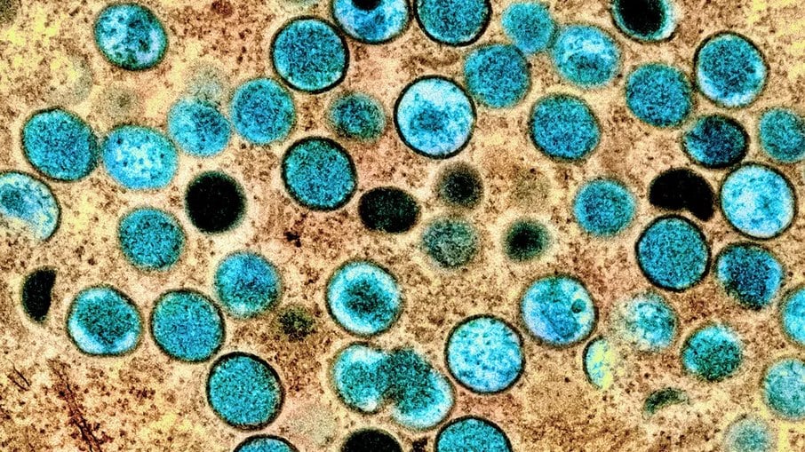 Imagem de microscópio colorizada artificialmente mostra vírus da varíola dos macacos (azul)
