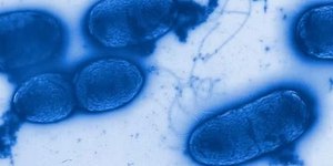 Pseudomonas: saiba qual bactéria foi encontrada na água Crystal