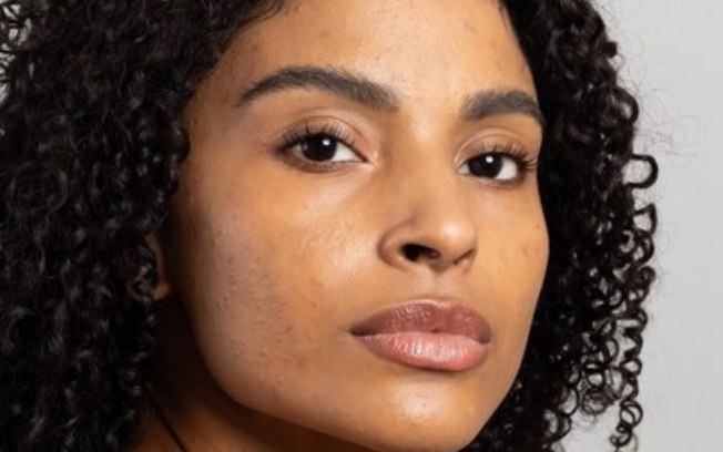 Cuidados de inverno para peles oleosas e com tendência à acne