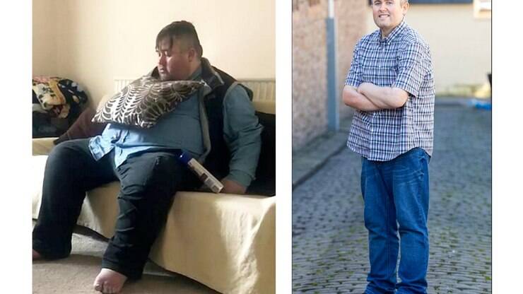 Homem corta 6,5 mil calorias da dieta e consegue emagrecer 107 kg