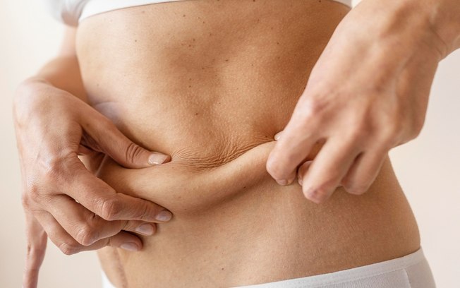 Tecnologia melhora retração da pele após lipoaspiração