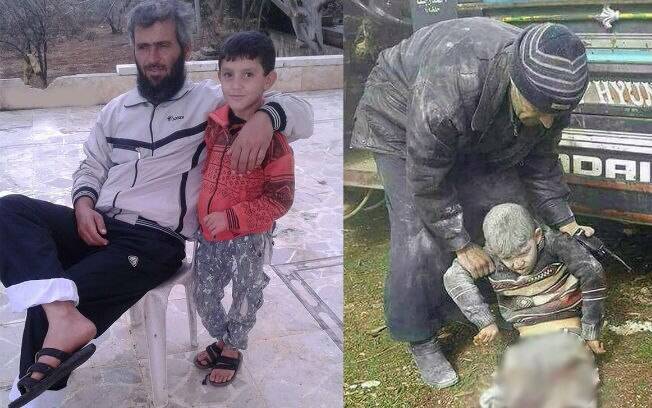 Nas fotos e vídeos feitos após o bombardeio que tirou suas pernas, o menino Abdulbasit aparece sem qualquer reação