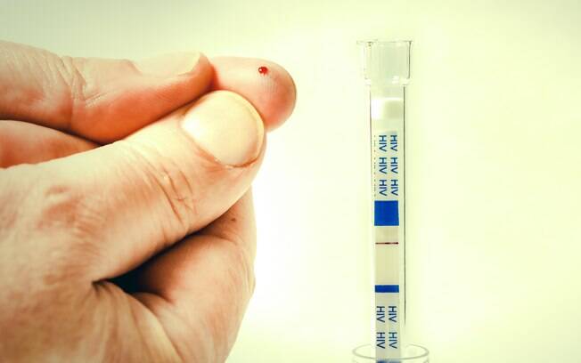 O teste de HIV deve ser feito sempre que a pessoa passar por uma situação de risco 