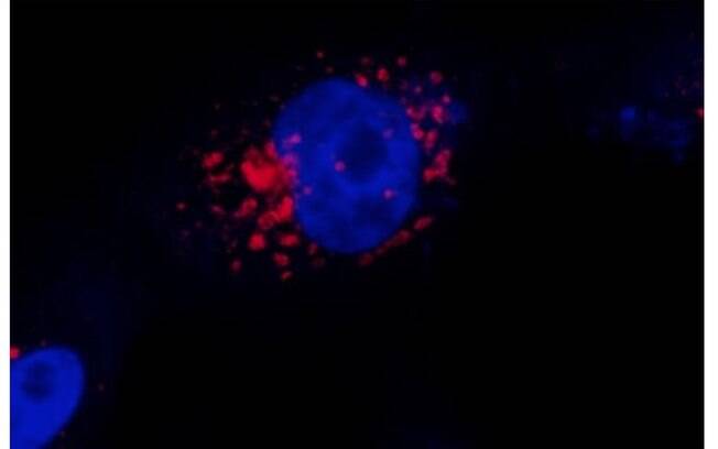 Tecnologia usa sonda que torna possível visualizar as substâncias virais por meio de luz fluorescente Tecnologia usa sonda que torna possível visualizar as substâncias virais por meio de luz fluorescente