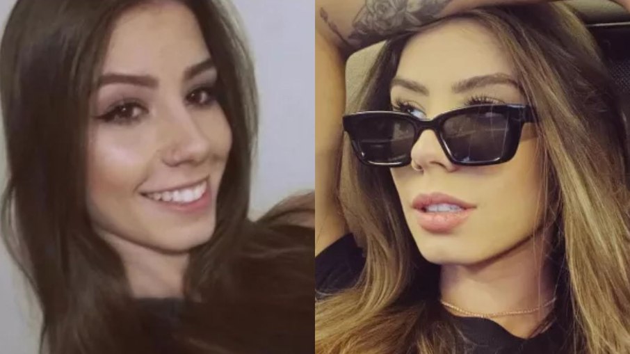 Antes e depois do preenchimento labial de Maria Lina