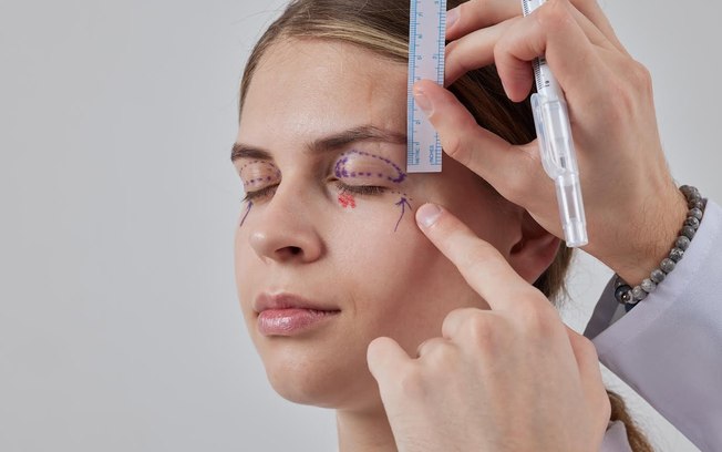 Blefaroplastia exige avaliação pré-cirúrgica individualizada