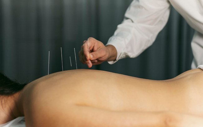 PICS: cresce aplicação de Medicina Chinesa PICS: cresce aplicação de Medicina Chinesa