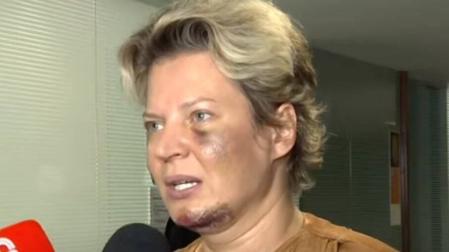 Joice Hasselmann depois dos ataques