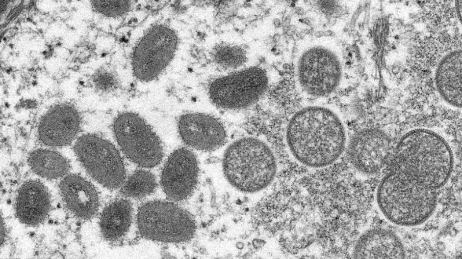 Nova York decreta estado de emergência para Varíola dos Macacos