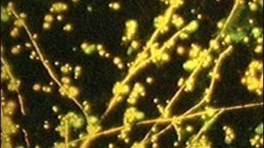 Candida, mancha fluorescente Candida, mancha fluorescente