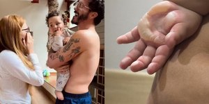 Filho de Viih Tube e Eli sofre queimadura e passa por cirurgia