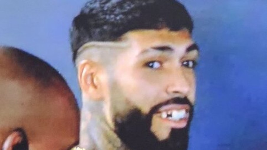 Barboza perdeu um dente na confusão Barboza perdeu um dente na confusão