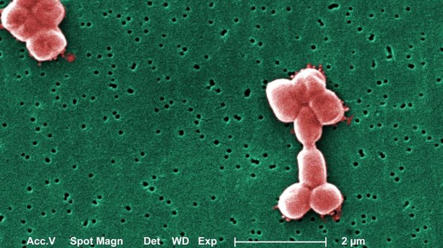 Acinetobacter baumannii