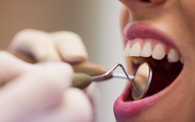 Sangramento na gengiva pede avaliação, alerta dentista
