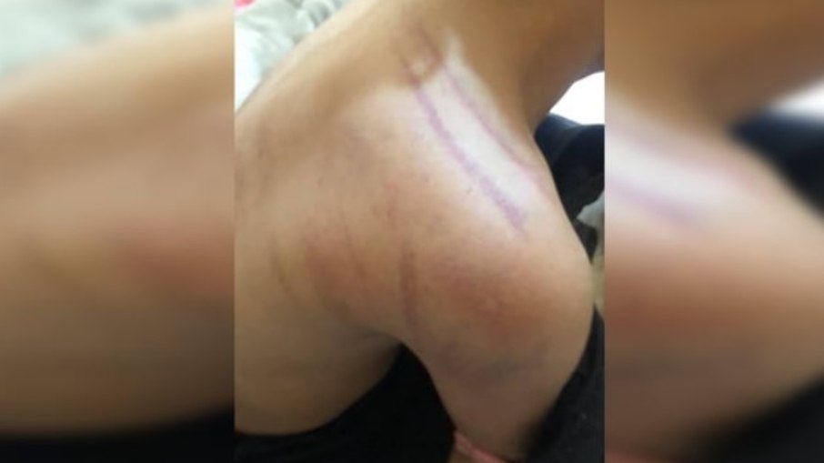 Menina apanha após beber achocolatado sem permissão do pai Menina apanha após beber achocolatado sem permissão do pai