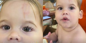 Filho de Virginia é mordido na escola e empresária expõe hematoma