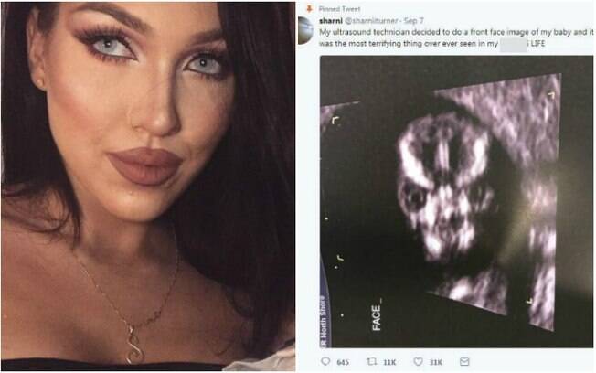 Sharni Turner postou uma foto do seu ultrassom e teve que lidar com inúmeros comentários maldosos