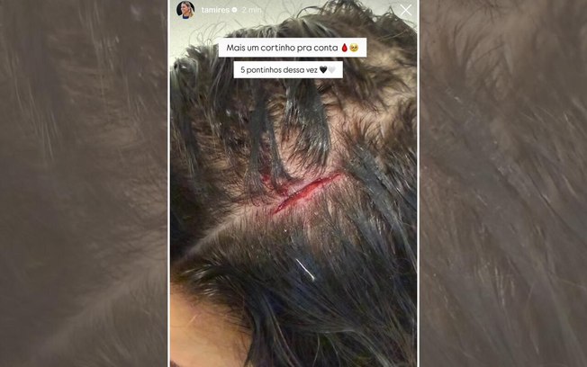Lateral sofreu choque no primeiro tempo e precisou de atendimento no vestiário