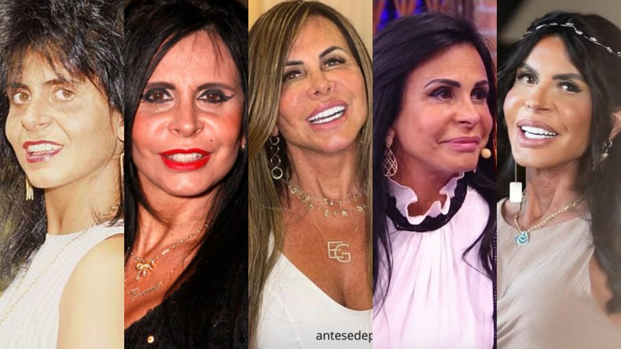 Antes e depois de Gretchen