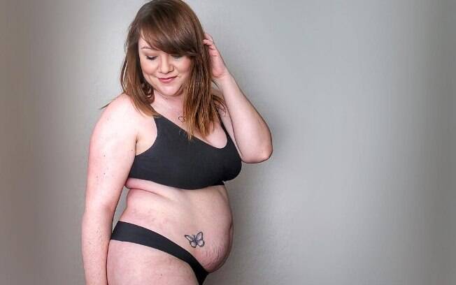 Kristyn Dingman compartilha nas redes sociais fotos do seu corpo pós-parto para inspirar outras mulheres