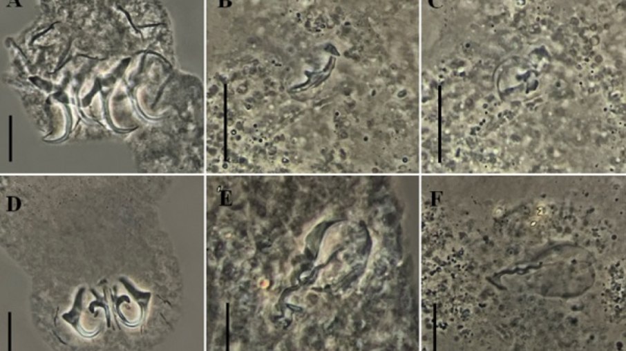 Novas espécies de Parasitos encontrados nos lambaris